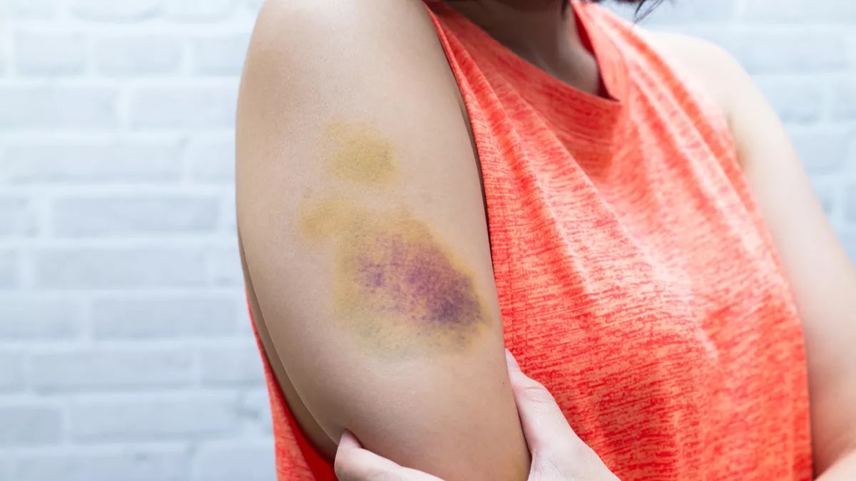 Яizal do tweet media