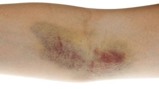 Яizal do tweet media