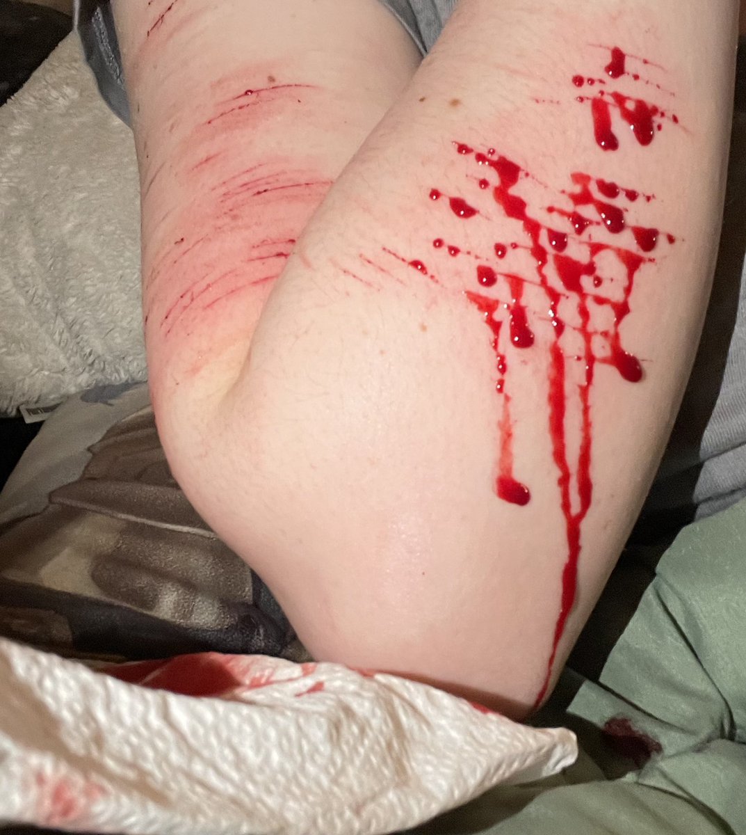 dumdoii_rammy tweet media