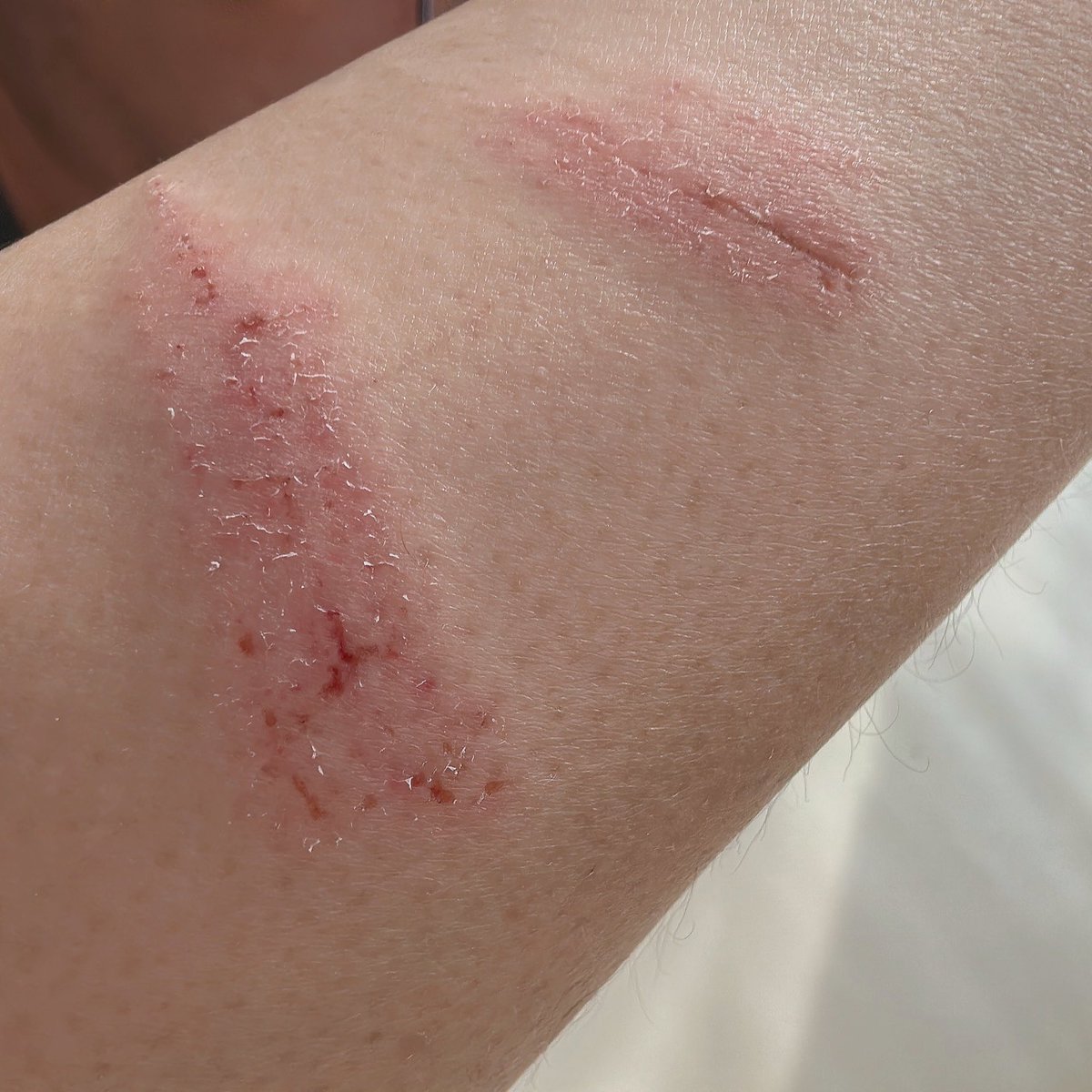 여름, 아름 tweet media