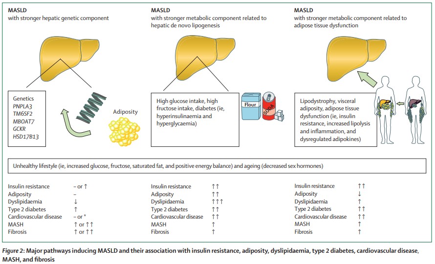 TheLancetEndo's tweet image. People with #MASLD can progress to cirrhosis and hepatocellular carcinoma and are at increased risk of developing type 2 #diabetes, #cardiovascular disease, chronic #kidney disease, and extrahepatic cancers thelancet.com/journals/landi… 
#T2D #CVD #CKD 
#OpenAccess