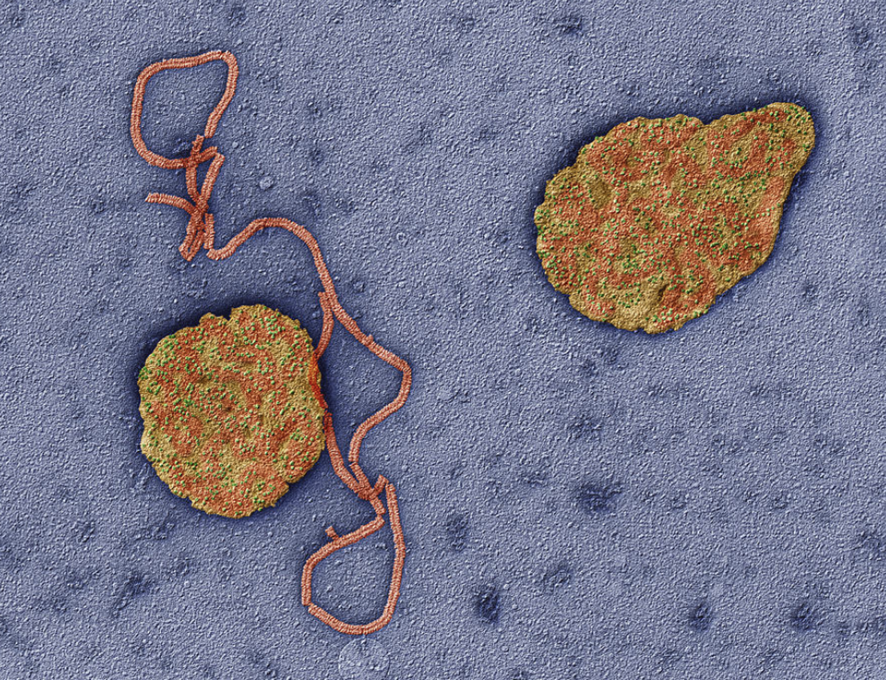 🚨 Crisis global de #sarampión: 

- 395,521 casos en 2024, cifra más alta en Europa en 25 años. 

- Cobertura vacunal cayó al 81%. 

- EE.UU. reporta 1,088 casos y 3 muertes en 2025. 

- La reticencia vacunal amenaza la eliminación.

📖 NEJM 2025;393(24):2447-58
#vacunas