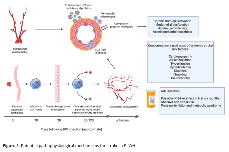 International Journal of Stroke on X: 