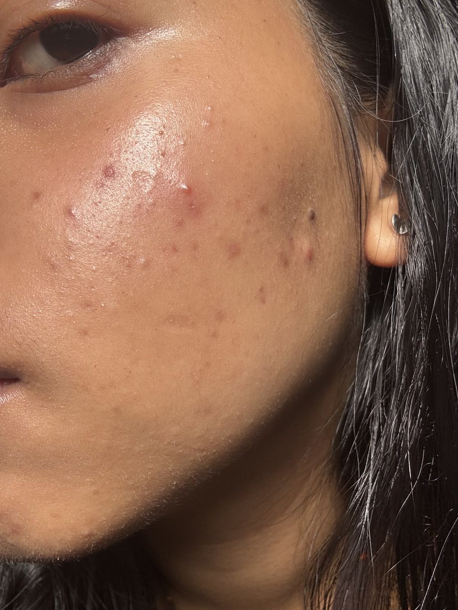 𝚂𝚘𝚘𝚔𝚒𝚎 𝚑𝚊𝚝𝚎𝚜 𝚢𝚘𝚞 🌸 tweet media