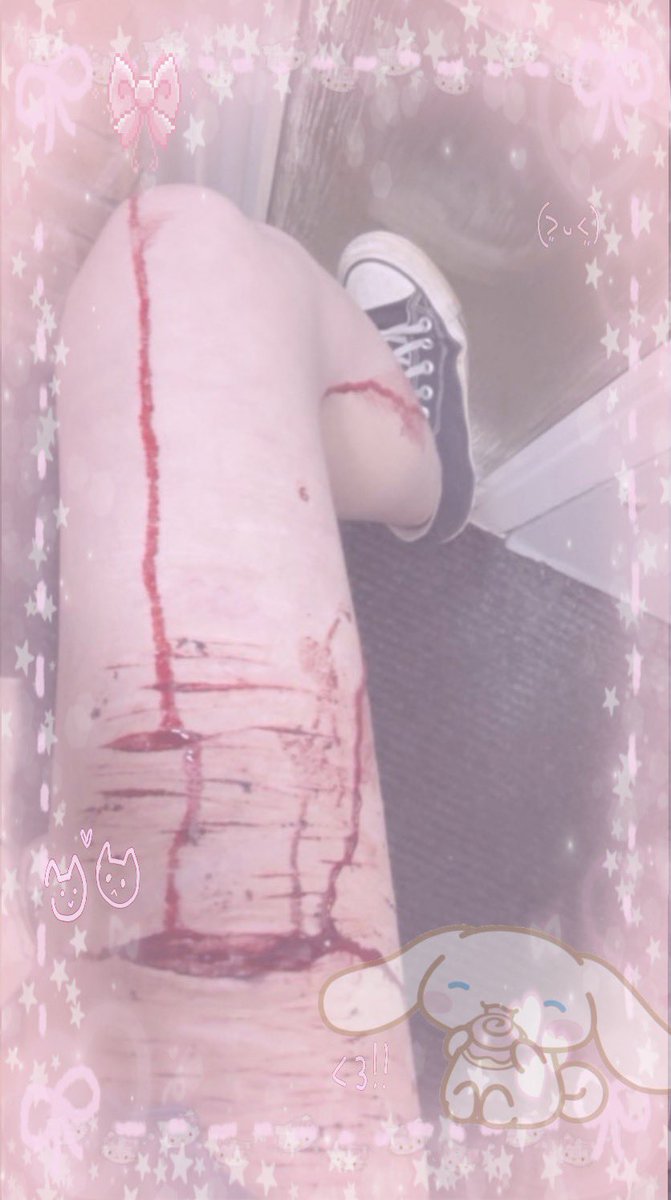 𝖧𝗎𝗆𝖺𝗇 𝖻𝗎𝗍𝖼𝗁𝖾𝗋 𝗈𝖿 𝗌𝗁𝖾𝖽𝗍𝗐𝗍 ★ tweet media