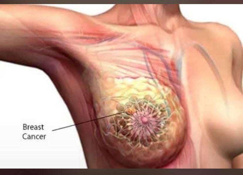 SindySolir's tweet photo. Dear All,

Please, if you know of any lady battling BREAST CANCER of whatever stage, please advise her to contact:

atilolaoluwafemi2022@gmail.com WhatsApp; 08140003578 or 07030712953 07065982532

All medical expenses are free.

Please don't keep this message to yourself, SHARE OR FORWARD to groups, and save that woman's life today.