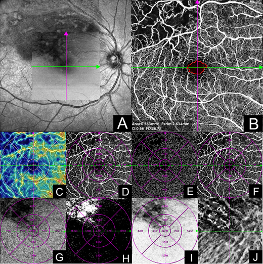 TVST Journal tweet media