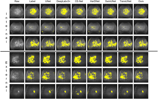 TVST Journal tweet media