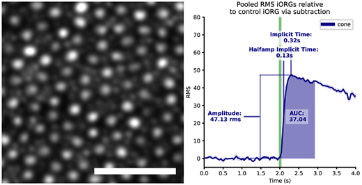 TVST Journal tweet media