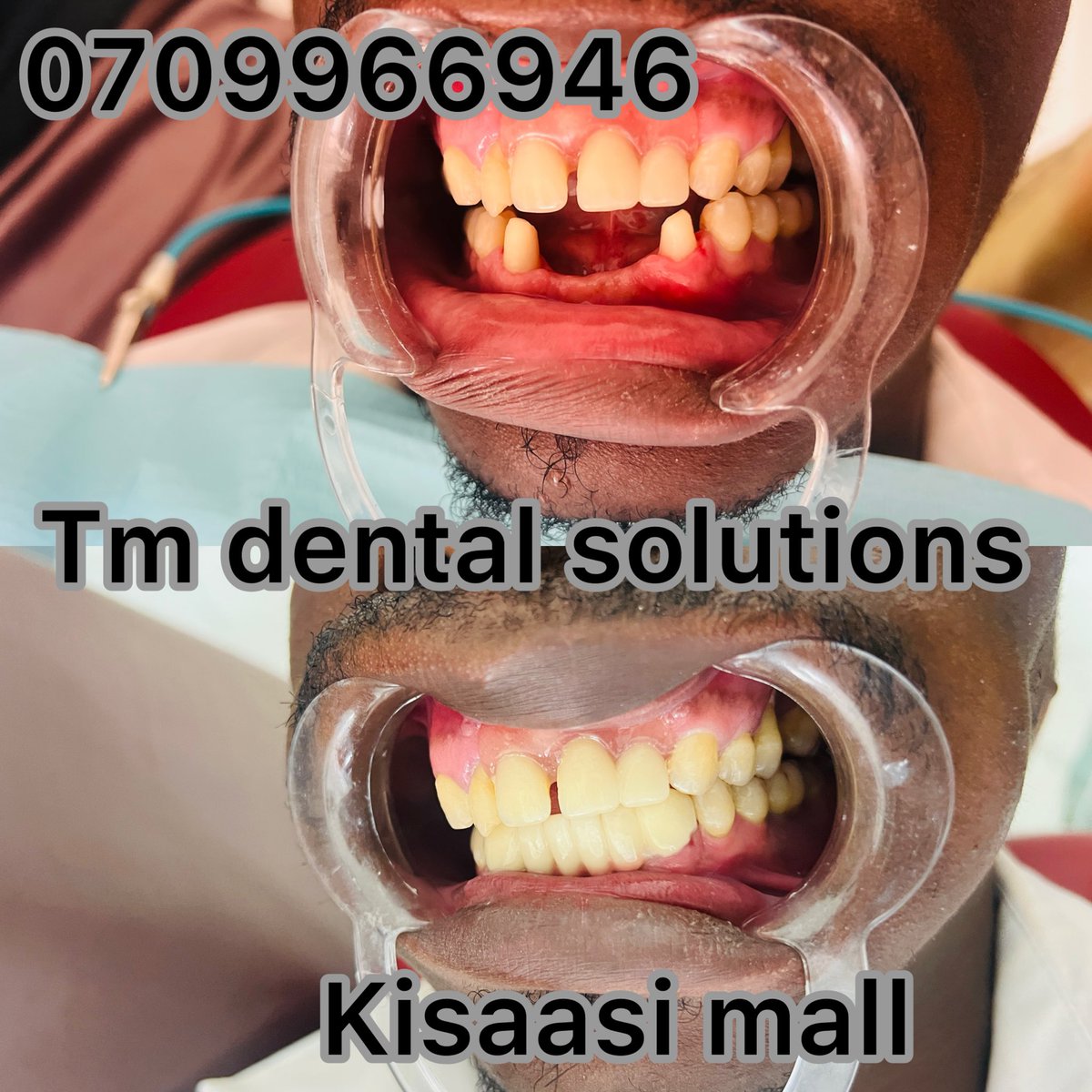Tm dental Solutions🇺🇬 (@tmdentalkampala) / Posts / X