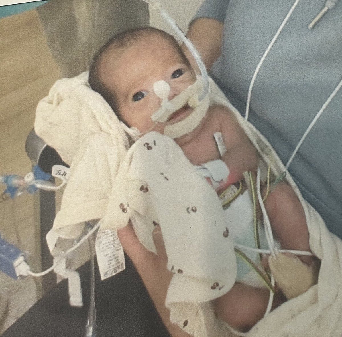 sn200915's tweet photo. NICU GCUに入院して4ヶ月。576gで生まれた娘の退院が決まりました㊗️
双子ちゃんだったけど、お兄ちゃんが生後1週間で亡くなり、あなたまでいなくなってしまうんじゃないかと、不安でたまらなかった😢
いろんな壁を乗り越えて、今では主治医の先生に、元気です👍と言われるね😄
帰ってくるの楽しみ💓 https://t.co/SZTfHAAxMZ