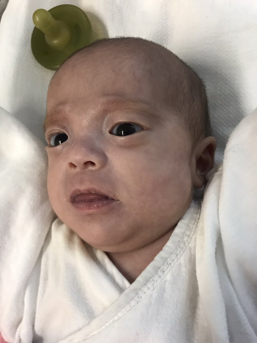 sn200915's tweet photo. NICU GCUに入院して4ヶ月。576gで生まれた娘の退院が決まりました㊗️
双子ちゃんだったけど、お兄ちゃんが生後1週間で亡くなり、あなたまでいなくなってしまうんじゃないかと、不安でたまらなかった😢
いろんな壁を乗り越えて、今では主治医の先生に、元気です👍と言われるね😄
帰ってくるの楽しみ💓 https://t.co/SZTfHAAxMZ