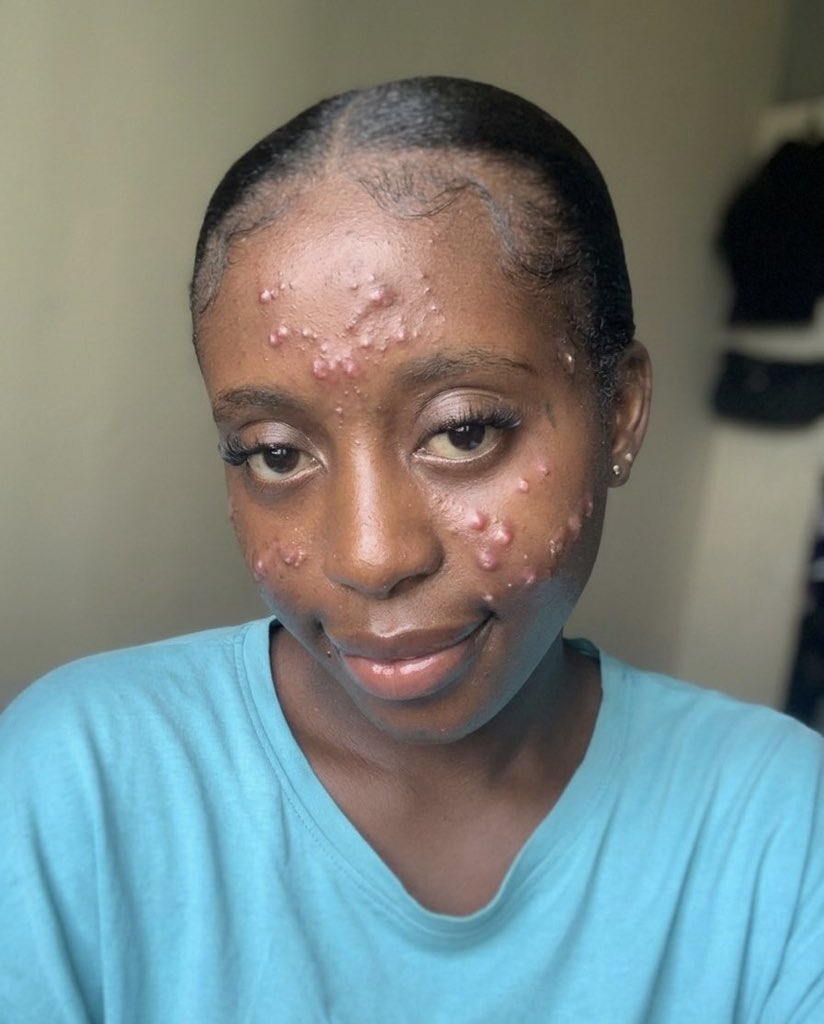 DAMI FOREIGN🥶 tweet media