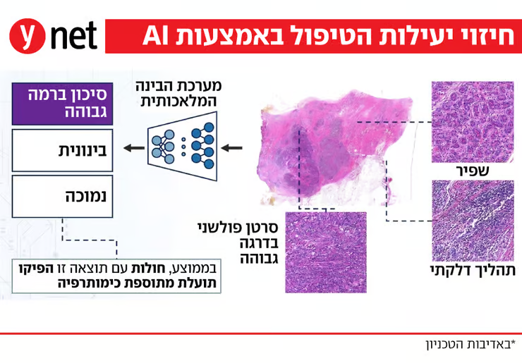 Dr_Doc_'s tweet photo. מי באמת צריכה כימותרפיה בסרטן השד? מודל AI מהטכניון נותן תשובה מיידית
בכל שנה מאובחנות בסרטן השד כ-5,000 נשים בישראל, כ-300 אלף בארצות הברית וכ-2.3 מיליון ברחבי העולם. מחקר חדש מהטכניון מציג מודל בינה מלאכותית שמנתח דגימות רקמה ומסייע לנבא למי מהמטופלות כימותרפיה צפויה להועיל, ובכך עשוי לצמצם טיפולים מיותרים ולשפר את קבלת ההחלטות הרפואיות

סרטן השד הוא הסרטן השכיח ביותר בקרב נשים. בכל שנה מאובחנות בו כ-2.3 מיליון נשים ברחבי העולם, וכ-5,000 מהן בישראל. אחת ההחלטות הקשות ביותר בטיפול בשלב מוקדם של המחלה היא האם להוסיף כימותרפיה אחרי הניתוח. מצד אחד, טיפול כזה יכול להשמיד תאי סרטן שנותרו ולהפחית את הסיכון לחזרת המחלה. מצד שני, לא בכל המקרים הוא באמת מועיל, ולעיתים הוא כרוך בתופעות לוואי קשות, פגיעה באיכות החיים ואף סיבוכים שעלולים להימשך זמן רב.

לכן, אחד האתגרים המרכזיים הוא לזהות כבר בשלב האבחון מי מהמטופלות באמת צפויה להרוויח מכימותרפיה. בהיעדר חיזוי מדויק, ההחלטות מתקבלות לא פעם תחת אי ודאות. התוצאה היא שחלק מהנשים מקבלות טיפול מיותר, בעוד אחרות עלולות לפספס טיפול שדווקא היה יכול לעזור להן.

כיום קיימות בדיקות גנומיות, ובראשן בדיקת "אונקוטייפ שד", שמסייעות להעריך את הסיכון לחזרת המחלה ואת התועלת האפשרית מכימותרפיה. אך לבדיקות האלה יש חסרונות: הן יקרות, עשויות להימשך שבועות ואינן נגישות לנשים רבות ברחבי העולם. בנוסף, הן אינן מדויקות לחלוטין, ולכן לעיתים מובילות גם להחלטות טיפול לא מיטביות. כל אלה עומדים מאחורי המאמץ העולמי לפתח פתרונות מדויקים יותר, מהירים יותר ונגישים יותר.

הדילמה שמטרידה כל מטופלת
על רקע הצורך הזה פיתחנו בטכניון, יחד עם פרופ' דביר ארן מהפקולטה לביולוגיה, מודל חדשני. המודל מוצג במאמר שפורסם השבוע בכתב העת המדעי היוקרתי The Lancet Oncology והוצג גם בכנס החברה האירופית לאונקולוגיה רפואית ESMO. המודל פותח במעבדה לעיבוד גיאומטרי של תמונות, בשיתוף פעולה בין-פקולטי, בין-תחומי ובין-לאומי עם רופאים, ביולוגים ופתולוגים מהטכניון וממוסדות מובילים בישראל, בארצות הברית ובאירופה. הוא מתרגם צורך קליני אמיתי לפתרון חישובי שניתן ליישם בפועל.

באמצעות שילוב של בינה מלאכותית מתקדמת עם מומחיות קלינית, המודל יודע להעריך את הסיכון להישנות סרטן השד ואת התועלת הצפויה מכימותרפיה. זאת על בסיס דגימת רקמה שנלקחת ממילא מהגידול במסגרת האבחון הראשוני. מדובר בכלי חדשני שעשוי לקרב את הרפואה המותאמת אישית לשטח, ולהציע למטופלות פתרון מדויק יותר, מהיר יותר וזמין יותר.

מה רואים שהעין האנושית מפספסת
המודל החדש יודע לנתח תמונות של דגימות רקמה ברזולוציה גבוהה, ולבחון אזורים שונים של הגידול וסביבתו. הוא מזהה דפוסים חזותיים שמעידים על ההתנהגות הביולוגית של הסרטן, כמו קצב חלוקת התאים, צורתם, מבנה הרקמה שמעיד על אגרסיביות, סימנים לפעילות של מערכת החיסון ומאפיינים נוספים שיכולים להעיד על רגישות או עמידות לטיפול. בפועל, המערכת סורקת כמות עצומה של מידע ומזהה גם רמזים זעירים שרופא אנושי, מנוסה ככל שיהיה, לא יכול לקלוט ולנתח במלואם.

המחקר נשען על ההתקדמות המשמעותית ביכולת של בינה מלאכותית לנתח תמונות גדולות ומפורטות במיוחד. בעשור האחרון הצטבר ידע רב בפיתוח מודלים לניתוח דגימות פתולוגיות, ובמקביל נבנו מאגרי מידע גדולים של דגימות דיגיטליות, שהם הבסיס לאימון מערכות אמינות. המערכת שלנו אומנה על יותר מ-170 אלף דגימות, והגיעה למשימה עם "הבנה" רחבה של עולם הפתולוגיה. לאחר מכן היא נבדקה על אלפי מטופלות נוספות בבתי חולים בישראל, בהם כרמל, העמק ושיבא, וגם באוסטרליה ובארצות הברית, והראתה ביצועים עקביים גם בקרב אוכלוסיות שונות.

בניגוד לבדיקות גנומיות, המערכת מנתחת ישירות את תמונות צביעת הרקמה הסרטנית ומפיקה מהן "חתימה חזותית" שמסייעת לנבא מהו הטיפול המתאים ביותר. היא מצליחה לזהות גם מידע שרופאים ופתולוגים אינם יכולים להבחין בו. דגימת הרקמה, שנלקחת כבר בשלב האבחון, נסרקת דיגיטלית ומועברת באופן מאובטח לניתוח. בתוך דקות מתקבל ציון מספרי שמעריך את רמת הסיכון ואת הסיכוי להפיק תועלת מכימותרפיה. זהו כלי תומך החלטה, שמסייע לרופא ולמטופלת לקבל החלטה מדויקת יותר לגבי המשך הטיפול.

תוצאה תוך דקות, בלי בדיקה גנומית
השימוש במערכת הראה יכולת חיזוי מדויקת ועקבית באוכלוסיות שונות ובבתי חולים מגוונים. אחד הגורמים המרכזיים לכך הוא גישה ייחודית לנתונים ממחקר TAILORx, מהמחקרים הגדולים והמשמעותיים בעולם בתחום סרטן השד. מדובר בניסוי רחב היקף שכלל יותר מ-10 אלף מטופלות, ומאפשר לבדוק בצורה אמינה האם המודל אכן יודע לנבא תועלת מכימותרפיה, ולא רק להעריך את הסיכון הסטטיסטי לחזרת המחלה.

זהו מודל הבינה המלאכותית הראשון מסוגו שאומת ככזה שמסוגל לנבא תועלת מטיפול בסרטן השד על בסיס דגימות פתולוגיות. התהליך מהיר ואינו דורש בדיקה גנומית מורכבת או דגימה נוספת מעבר למה שנלקח ממילא. המשמעות היא בדיקה פשוטה יותר, מהירה וזולה, שניתן לבצע כמעט בכל מעבדה פתולוגית עם ציוד בסיסי וחיבור לאינטרנט.

במדינות מתפתחות, שבהן בדיקות גנומיות כמעט אינן זמינות, מדובר בפוטנציאל להרחיב משמעותית את הגישה לרפואה מותאמת אישית. גם במדינות מערביות הכלי עשוי לקצר תהליכים, להפחית עלויות ולשפר את הדיוק באבחון.

במקביל לקידום הטמעה בישראל ולניסויים קליניים במדינות נוספות, נעשים מאמצים לשפר עוד את דיוק המודל ולהרחיב אותו לסוגי סרטן וטיפולים נוספים. ההערכה היא שבעתיד הקרוב כלים מבוססי בינה מלאכותית יהפכו לחלק בלתי נפרד מתהליך קבלת ההחלטות באונקולוגיה וברפואה בכלל.
https://t.co/JSIoU6D0cd

https://t.co/S8pNRTgD5i