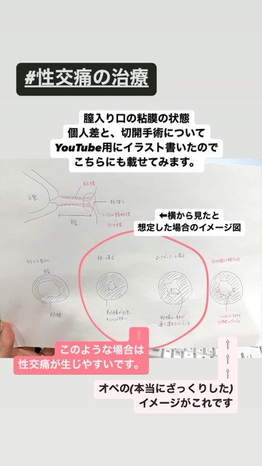 ゆき先生@婦人科形成 tweet media