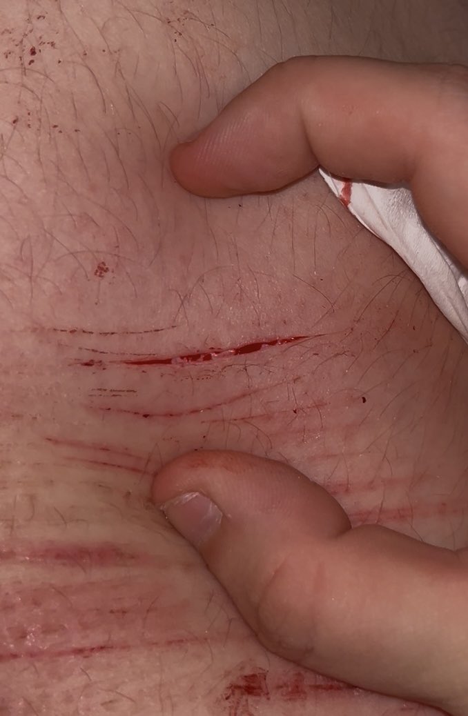 cedar of shtwt tweet media