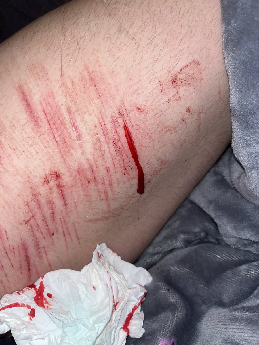 cedar of shtwt tweet media