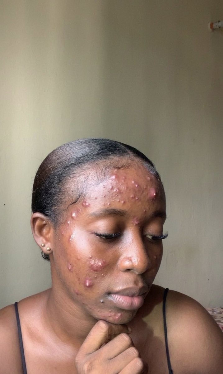 ÃJ.☆☄️ tweet media