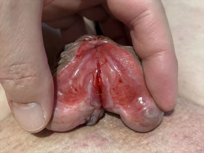 Love Penectomy tweet media