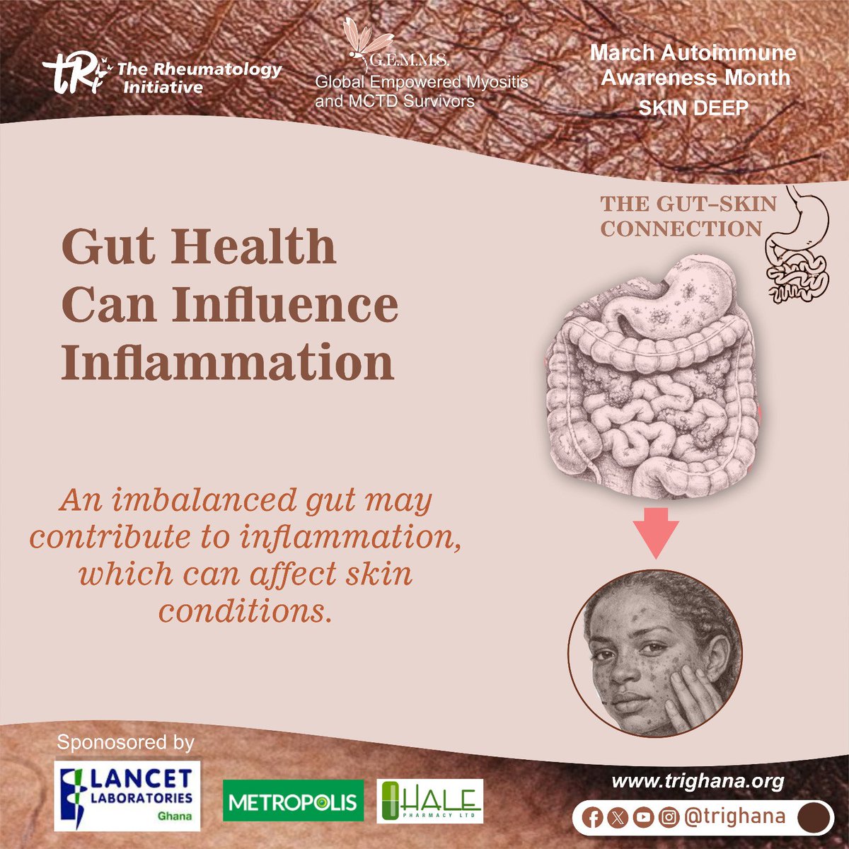trighana's tweet photo. Remember that an imbalanced gut doesn't always stay in the gut. 
It can show up as inflammation &amp; breakouts, redness and sensitivity can all trace back to what's happening internally.
 #SkinandAutoimmunedisaease
#Shiningthroughthebumpsandscars
#Skindeep
#tRi
#GEMMS https://t.co/HtLMvqt3og