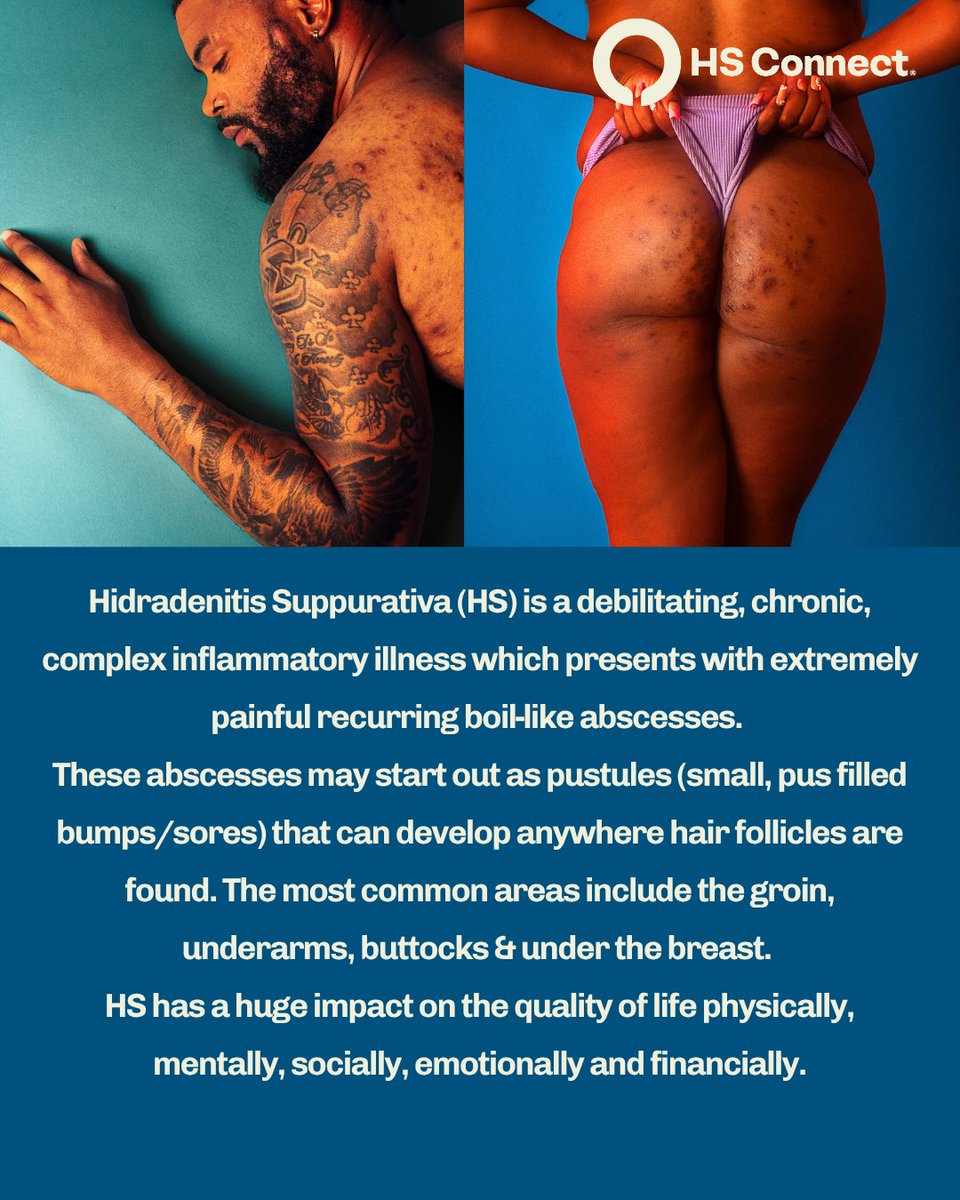 HSconnect.org - HS Connect tweet media