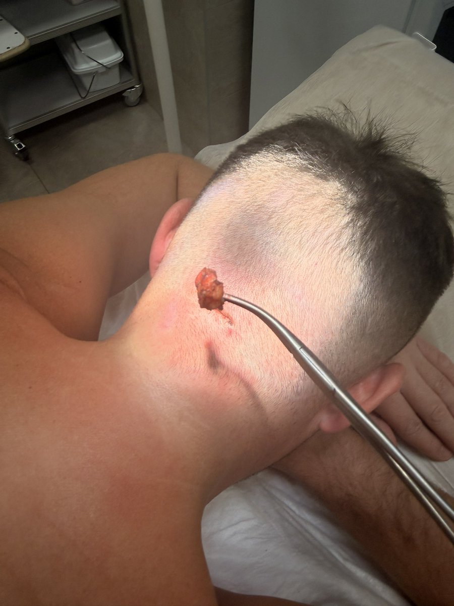 сложный углевод tweet media