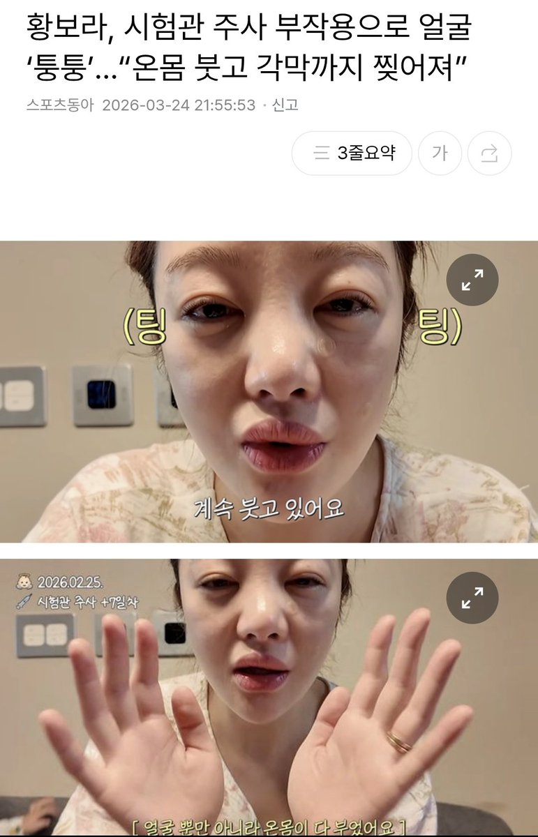 🥖 🌹청경채톡톡☂️ tweet media