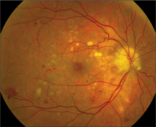 Retinal Physician tweet media