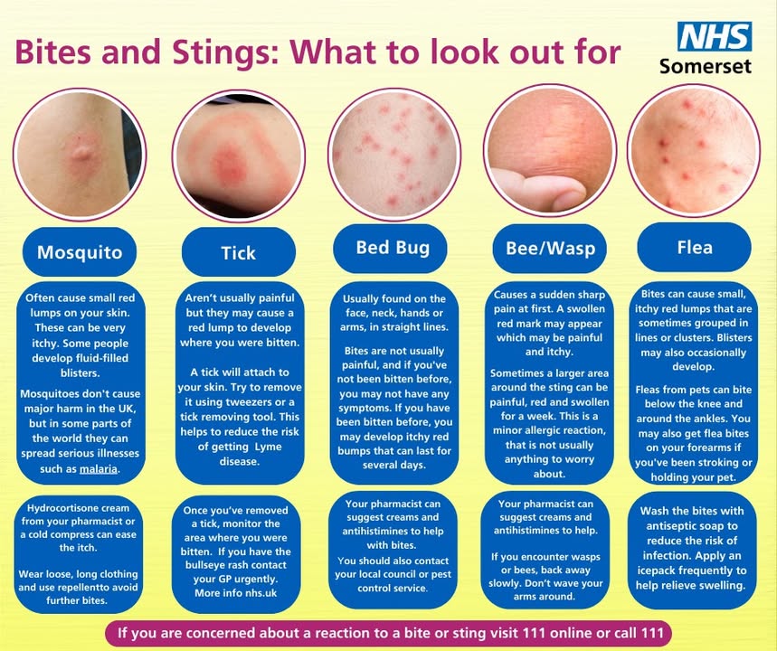 NHSSomerset's tweet image. 🌻 As warmer weather returns, remember to save and share this helpful guide for bites and stings when you're out and about.

#halfterm #easter #somerset #NHS