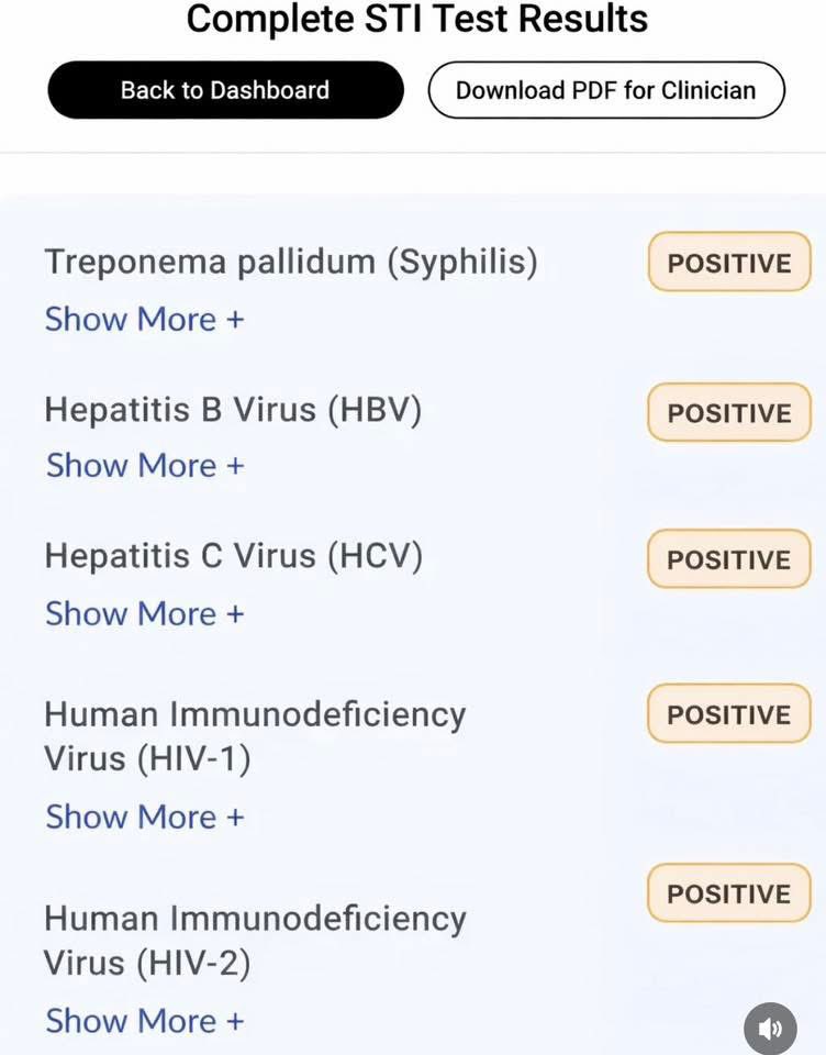 ✨𝐓𝐈𝐍𝐘 The INSPIRATION 💫 tweet media