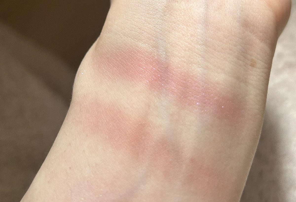 Rino🕊️ tweet media