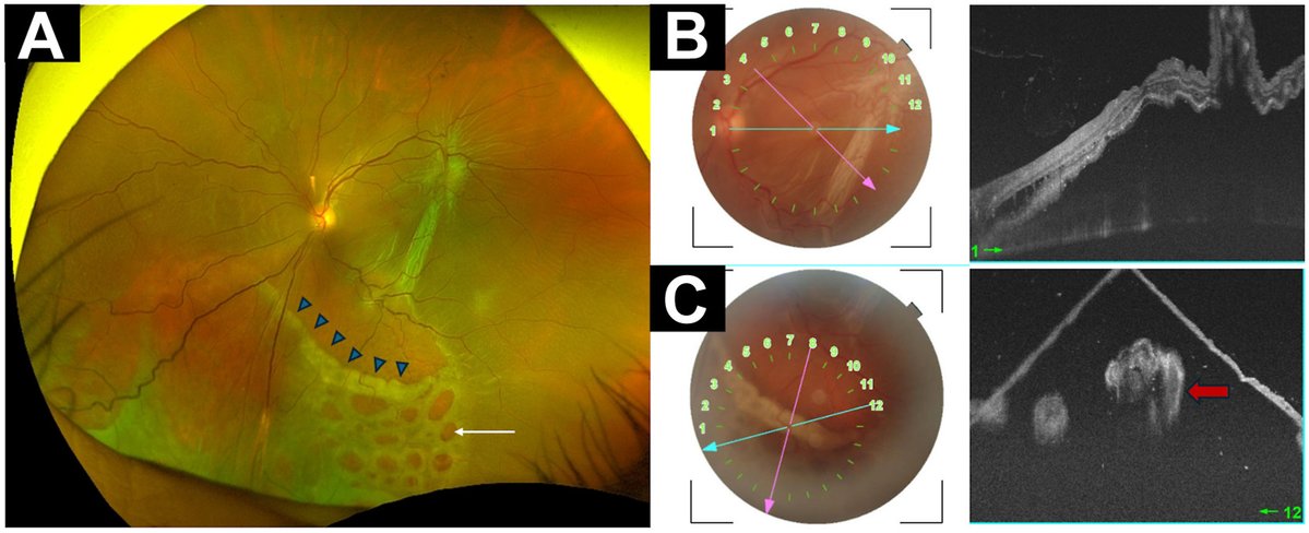 Ophthalmology tweet media