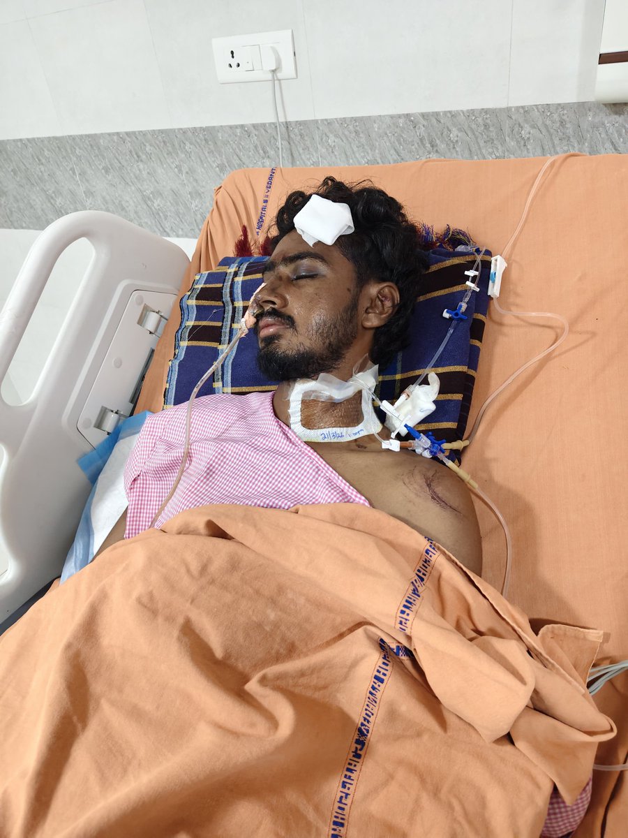 vakeel_kalyan's tweet photo. దయచేసి స్పందించండి 🙏🙏

మన తోటి జనసైనికుడు కిషోర్ రోడ్డు ప్రమాదంలో తీవ్రంగా గాయపడ్డాడు

కడప వేదాంత ఆసుపత్రిలో ఉన్న అతని పరిస్థితి విషమంగా ఉంది..ఆపరేషన్ కోసం 2లక్షలు ఖర్చు అవుతుంది..

దయచేసి అందరూ ముందుకు వచ్చి సహాయపడాలని ప్రార్థన 

ఫోన్ పే : 7993041822 https://t.co/H4a4AU73sK