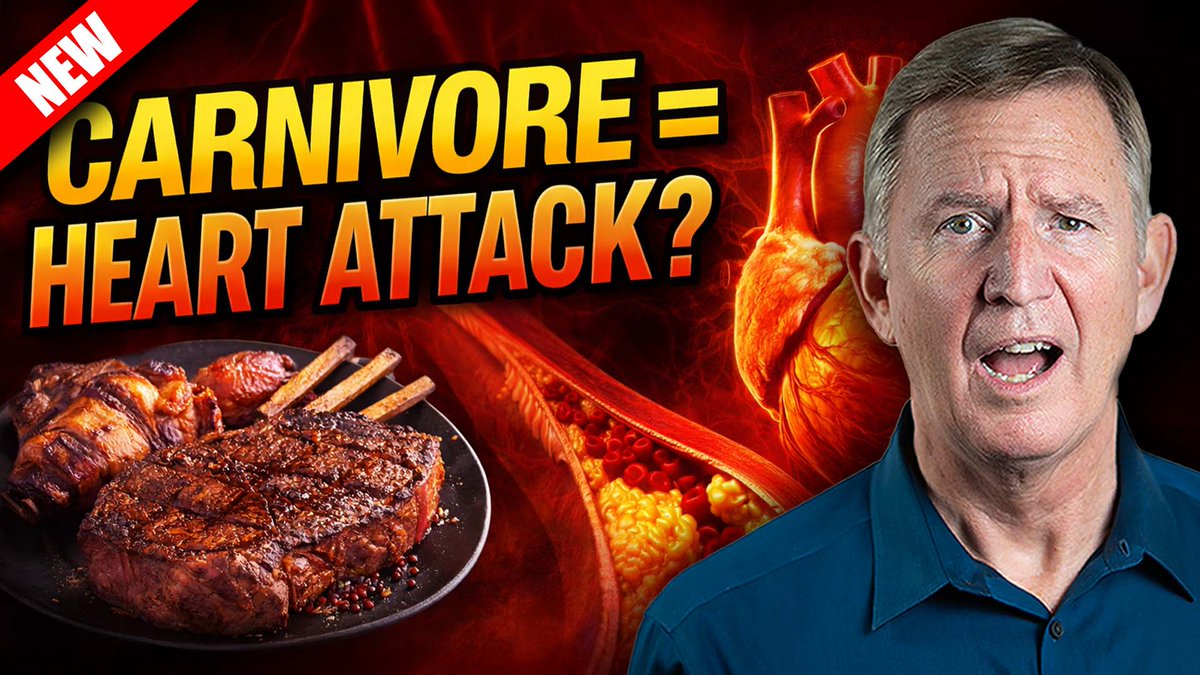 drericwestman's tweet image. 😱Can You Get Heart Disease On A Carnivore Diet?🤔 Doctor Reacts
⬇️CLICK THE LINK BELOW⬇️
youtu.be/w55UnqSaUKw

#CarnivoreDiet #HeartDisease #Keto #DrEricWestman