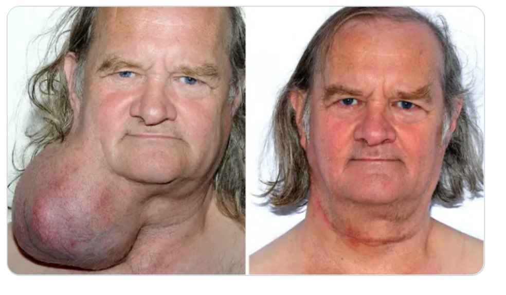 @dietaanimal tweet media