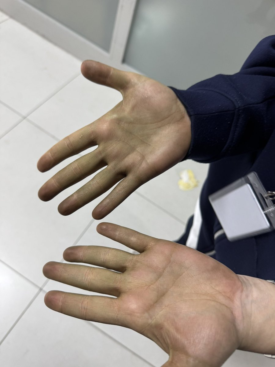 mercimek köftesi 🇹🇷 tweet media