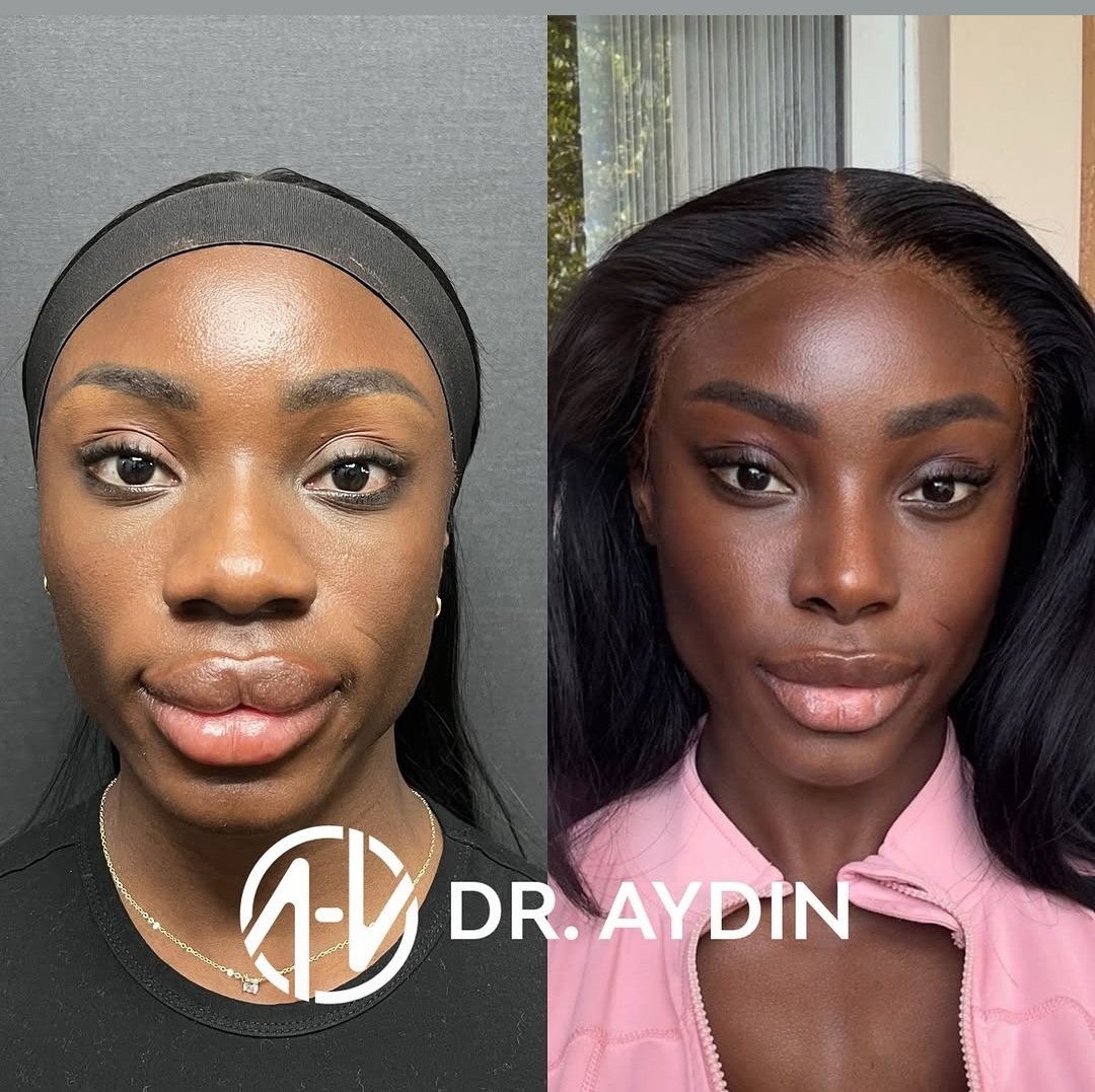 White Prime tweet media