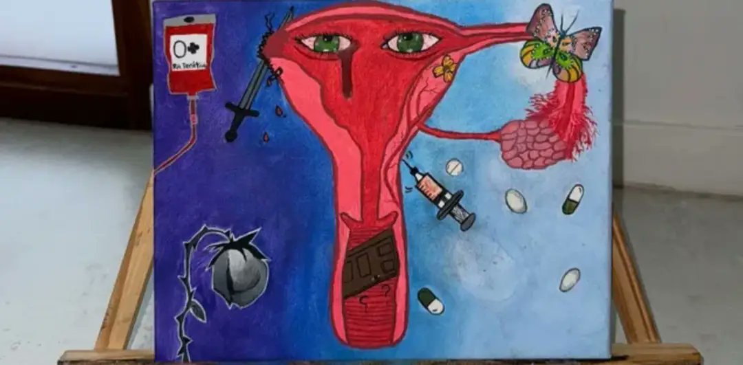 Godney ☆ tweet media