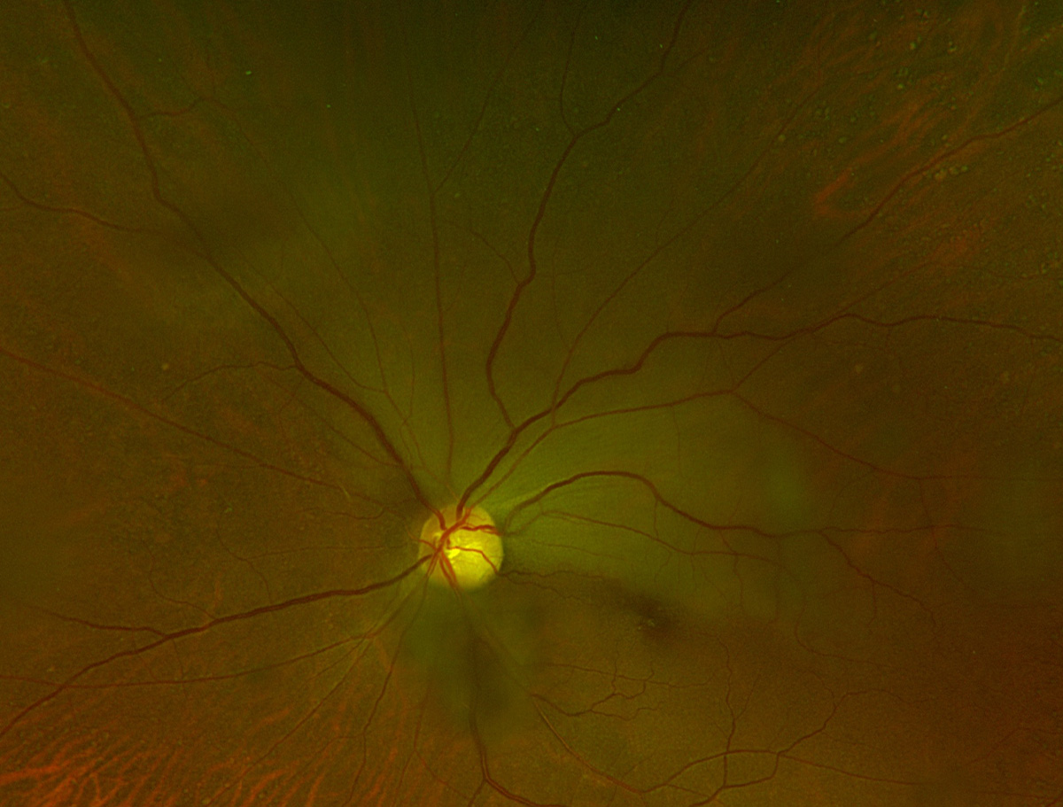 Review of Optometry tweet media