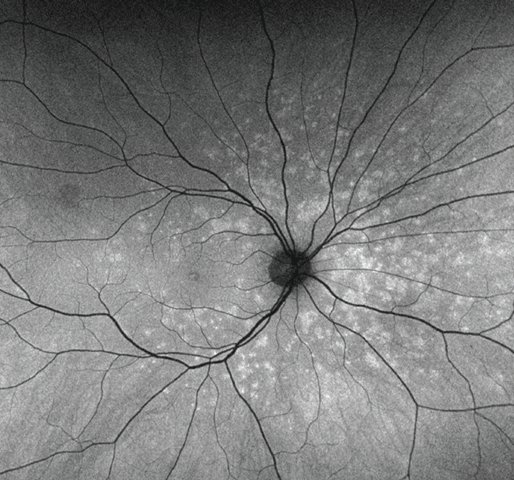 Review of Optometry tweet media