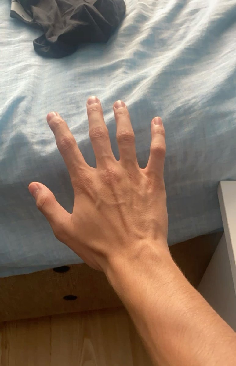 gingeraleshane's tweet image. Got my nails done #NewNails #iLostTheBet