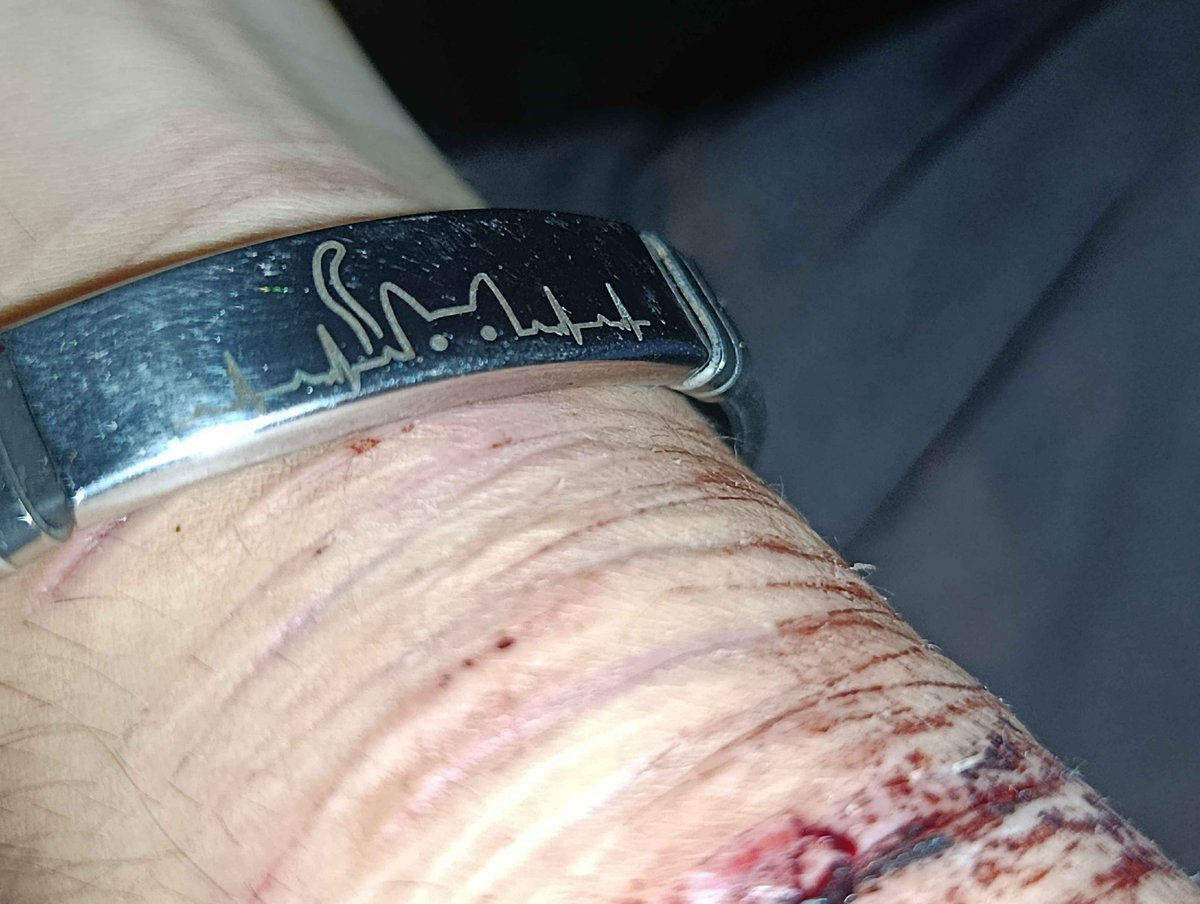 eLizolam tweet media