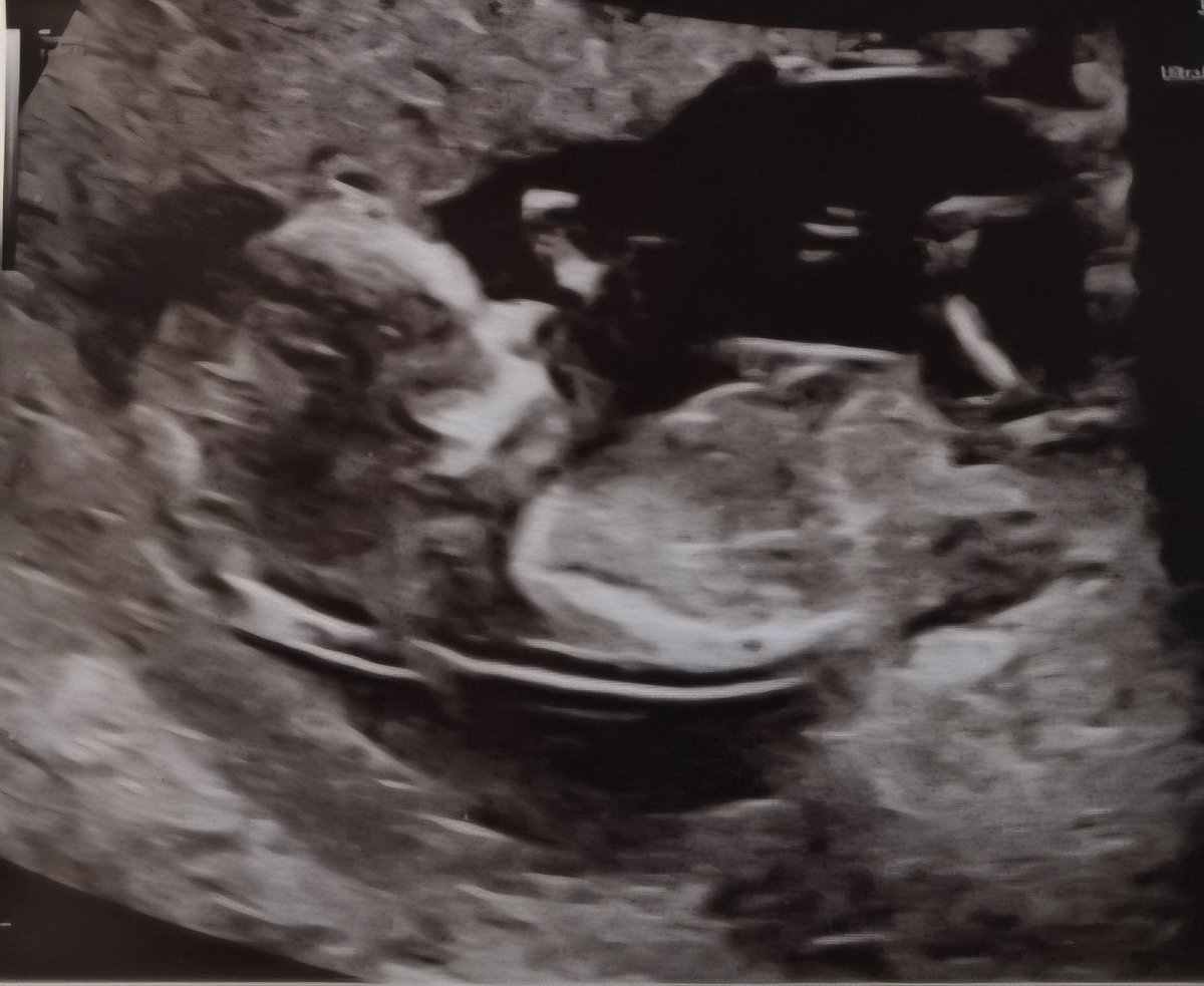 Master Salling 🫀 tweet media