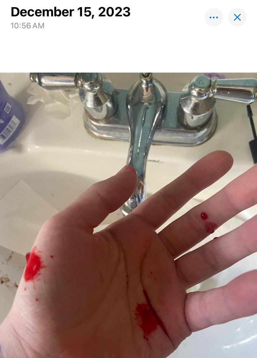 billcipherlover's tweet photo. i’m counting the nosebleed i got while melting down over the book of bill to be blood shed over bill cipher . #myblood 🫀 i should have used it to write a letter to him that just said “AAAAAAAAAAAAAAAAAAAAAAAAAAAAAAAAAAAAAAAAAAAAAAAAAAAAAAAAAAAAAAAAAA!!!!” https://t.co/1gGKdsmgKU