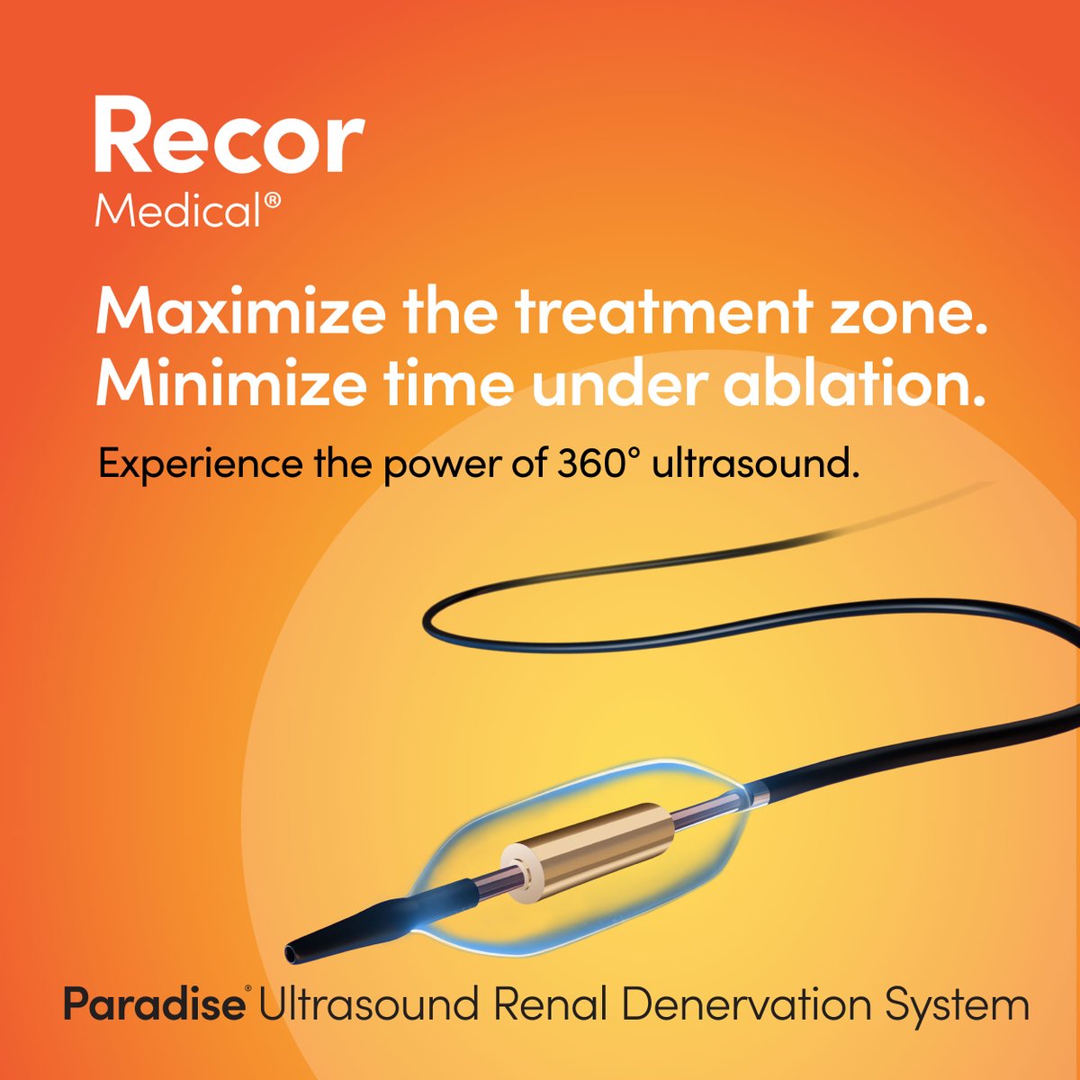 RecorMedical's tweet photo. Maximize the treatment zone. Minimize time under ablation.

Empower your procedures with 360º ablation technology—a breakthrough in RDN that penetrates more effectively with targeted depth by reaching sympathetic nerves around the renal artery, all while staying in the main vessel without entering distal branches.¹

🔸Engineered for efficiency: shorter ablation time, fewer total ablations, less fluoroscopy, and less contrast volume.²⁻³

🔸Deliver a predictable experience while minimizing discomfort for your patients.⁴

Experience the power of 360º ultrasound.

Prescription only. Results may vary. Important Safety Information:  https://t.co/RQE3vnYwlh

#ParadiseURDN #Hypertension

*Treatment site may vary with anatomy. Please refer to Paradise Catheter IFU for treatment strategy.