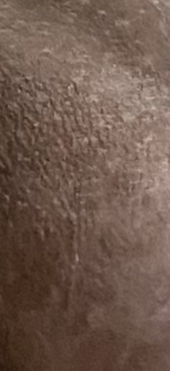 Bonito de Pau tweet media