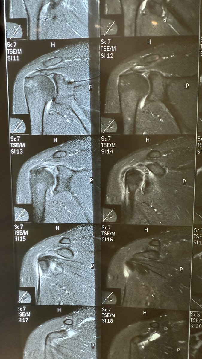 tuliviki tweet media