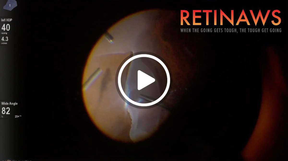 Retina Today tweet media