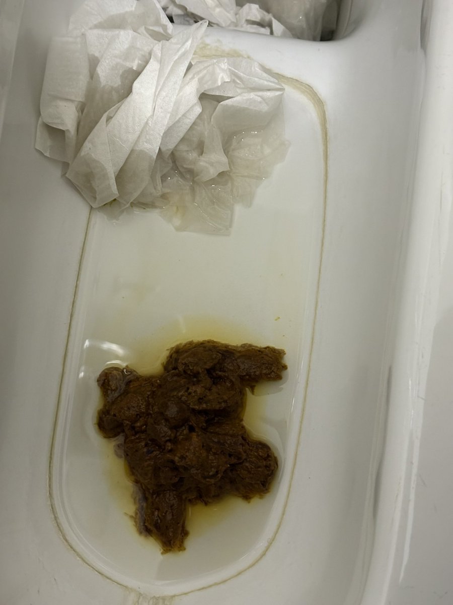ipipipip0512's tweet photo. 💩

#スカトロ #うんち #浣腸 #アナル #裏アカ男子 https://t.co/AHRUuLH6Ft