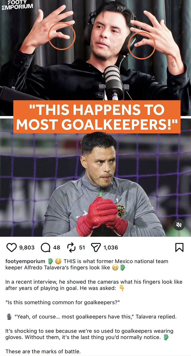 This genuinely terrified me
It might be time to wrap this up, especially since I’m currently recovering from two dislocated fingers in two months